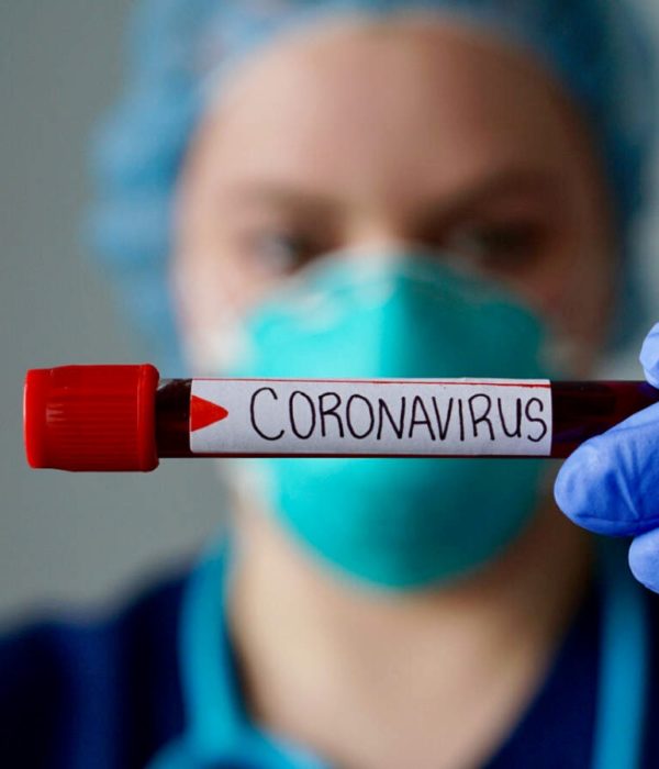 Test privado de coronavirus